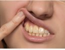 أبرز أسباب اصفرار الأسنان.. لا تتجاهلها