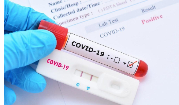 علماء يكشفون عن مدة المناعة بعد الإصابة بوباء كورونا