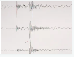 أبو كركي: لا داعي للقلق من زلازل المنطقة وصفائح الأردن تحتاج مئات السنين لحدوث زلزال متوسط