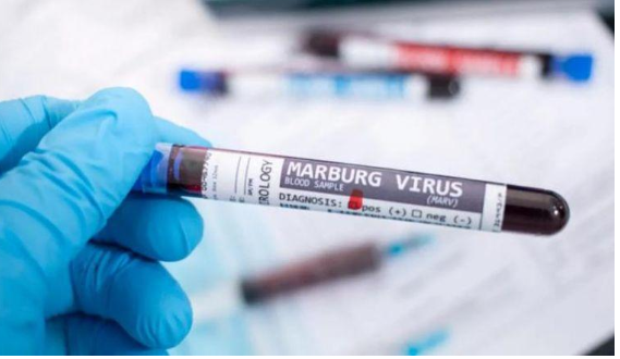 إسبانيا ترصد أول إصابة مشتبه بها بفيروس ماربورغ
