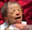 فيديو متداول لطفل حديث الولادة بوجه رجل عجوز يثير الجدل ( صور)!