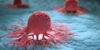 علماء يكتشفون مؤشراً يؤكد الإصابة بسرطان البروستاتا