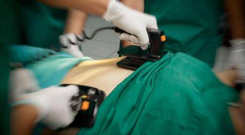 توقف قلبه مرتين لمدة 27 دقيقة .. إنقاذ حياة معتمر داخل الحرم المكي