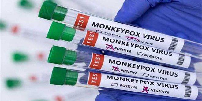 باكستان تعلن اكتشاف أول إصابة بجدري القردة على أراضيها