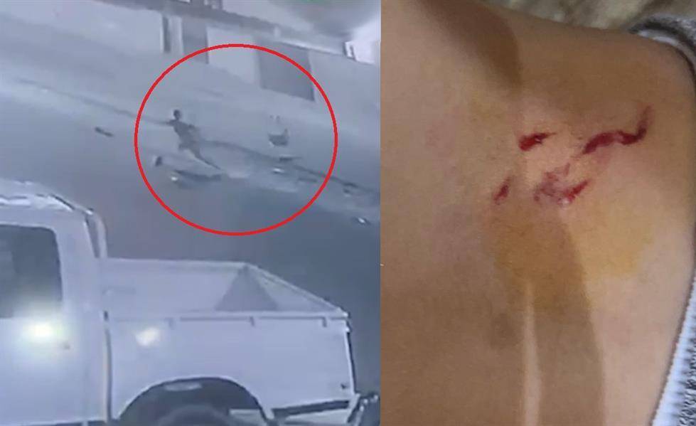 كلب يهاجم طفلا بالقريات ويصيبه بجروح