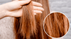 علاجات طبيعية لتحفيز نمو الشعر