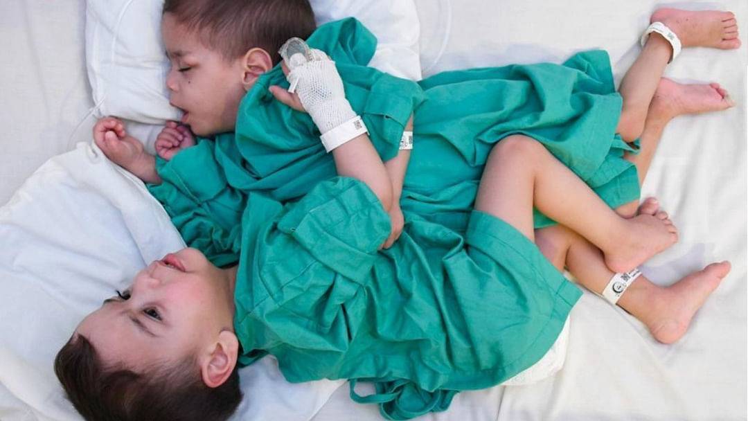 الدكتور ربيعة يبدء عملية فصل التوأمين السياميين السوريين بسام وإحسان في السعودية