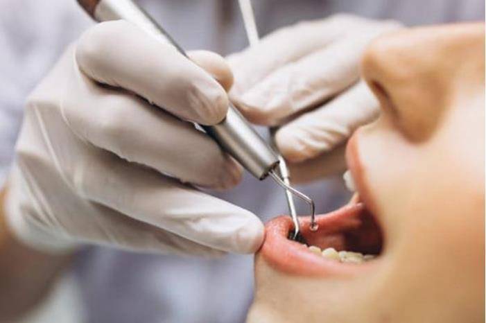 الحبس شهرين لطبيب أسنان أردني خلع السن وترك الجذر