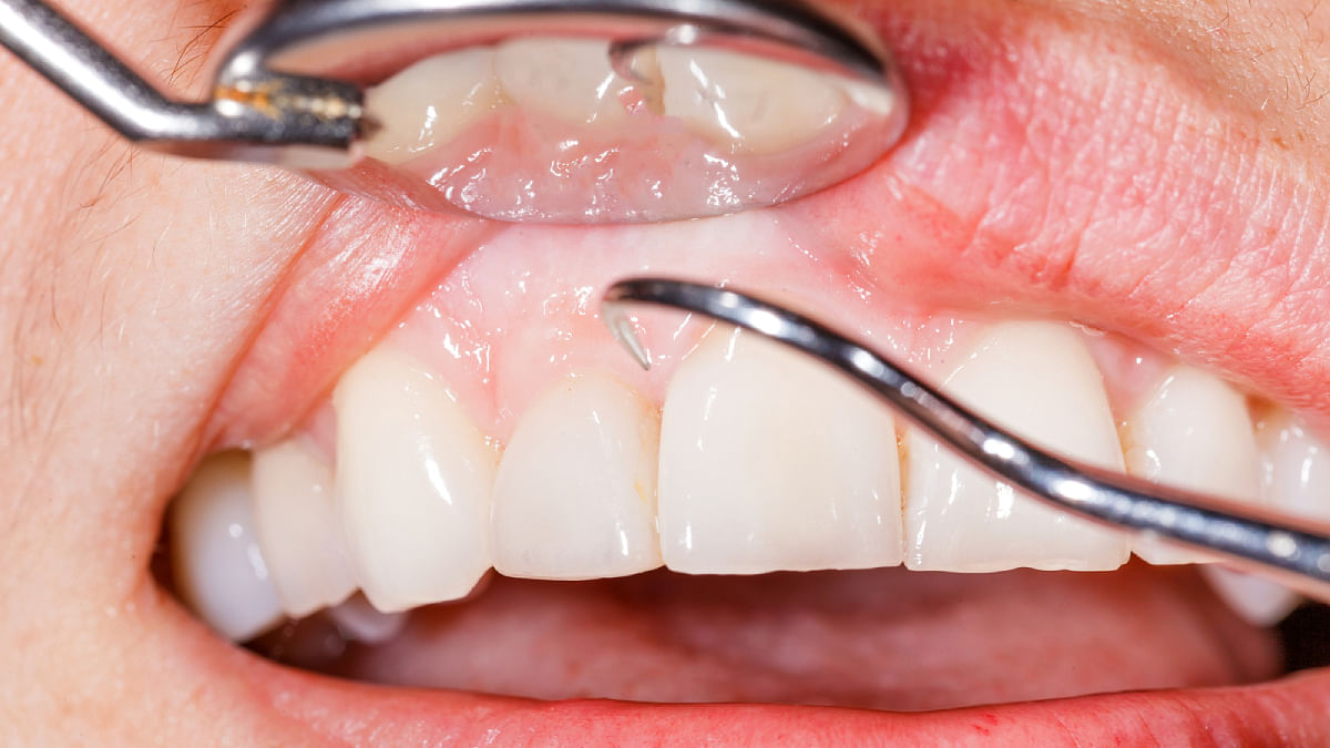علاج لإعادة نمو الأسنان