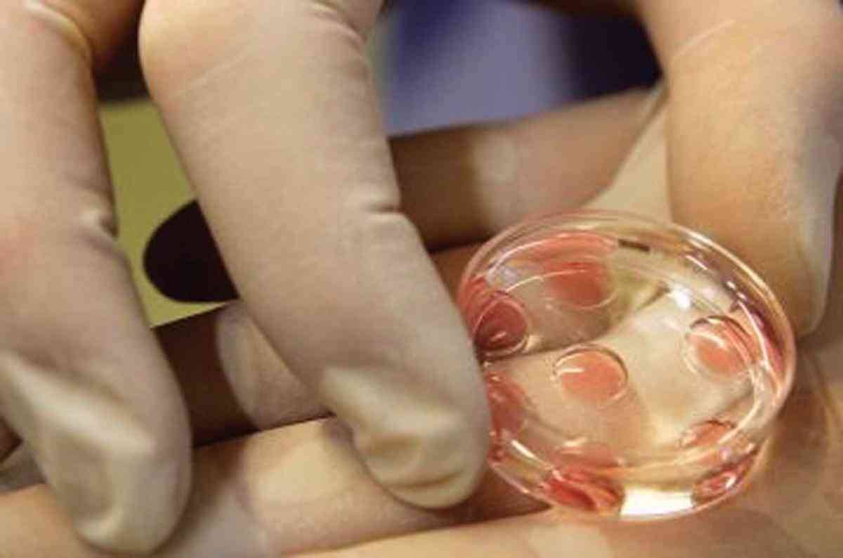 خطر يُهدّد معايير الطب والقانون والاخلاق.. تجميد البويضات للعزباء في أحد الفنادق