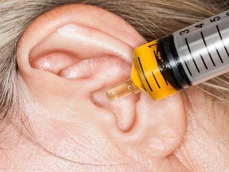 أسباب غير متوقعة لالتهاب الأذن الوسطى عند الأطفال