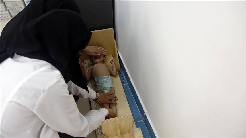 الأغذية العالمي: نقص التمويل يهدد 24 مليونا بالمجاعة العام المقبل