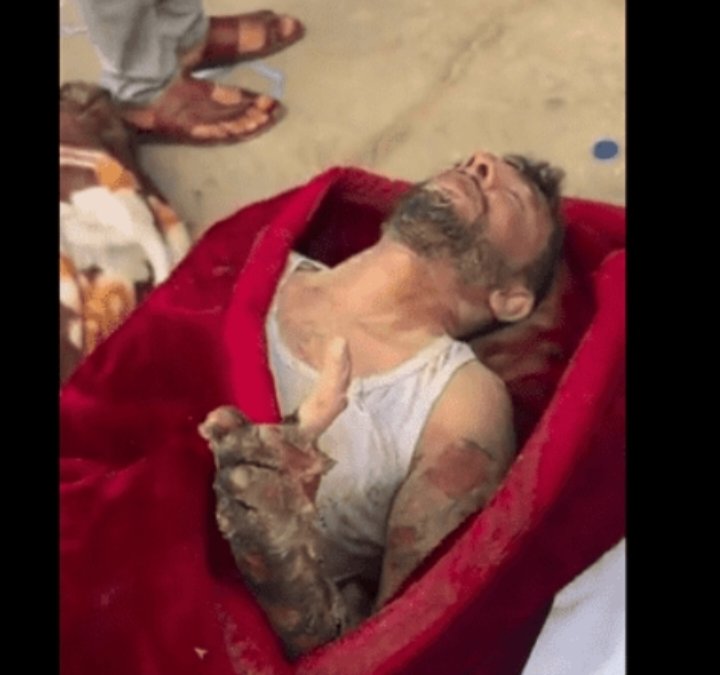 السبابة التي ستخاصمنا أمام الله يوم القيامة وستشهد على خذلاننا كعرب لاهلنا