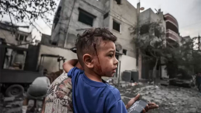 المرصد الأورومتوسطي: الاحتلال الإسرائيلي صعد حرب التجويع بحق أهالي غزة كأداة لإخضاعهم