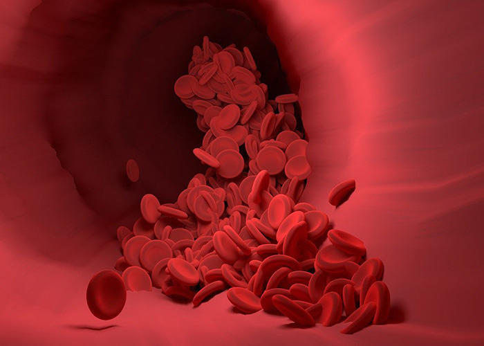 مخاطر ومضاعفات زيادة خلايا الدم الحمراء الحقيقية