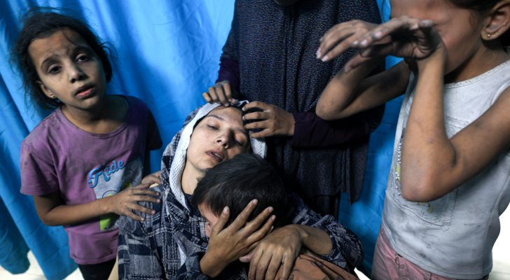 الجراح غسان أبو ستة : 45 من المصابين بالحروق في مستفى الشفاء بغزة كانوا اطفالا