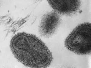 انتشار الجدري جنوبي قطاع غزة.. هل يتحول إلى وباء؟