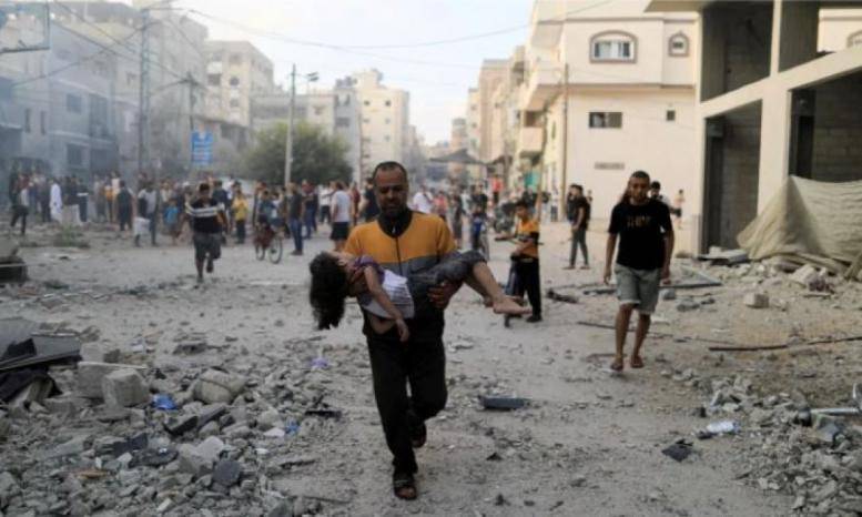 اليونيسف: أكثر من 1000 طفل في غزة بترت ساقهم من جراء القصف الإسرائيلي