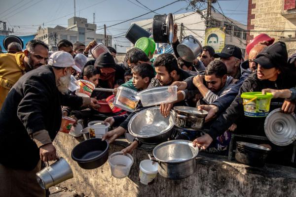 مستشفى يستقبل يوميًا 500 طفل يعانون من سوء التغذية في غزة