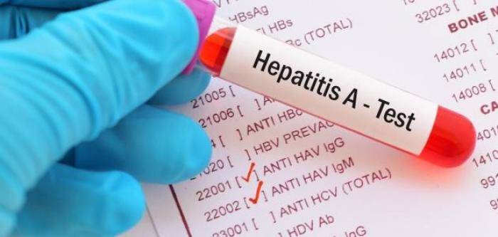 أنباء عن اصابات بالكبد الوبائي في مدرستين بالسلط .. ومدير التربية : الوضع مطمئن