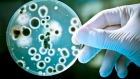الصحة العالمية تحدث قائمة البكتيريا المقاومة للأدوية الأشد خطرا