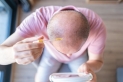 عقار يعالج تساقط الشعر يؤثر على خصوبة الرجال