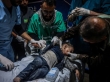 نيويورك تايمز: الأطباء بغزة يجبرون على بتر أطراف كان يمكن علاجها
