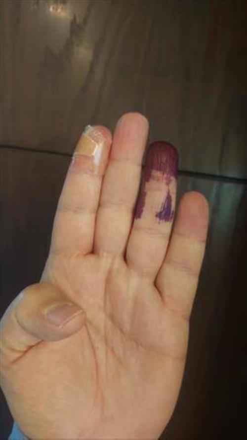 حجز مقترع في ثالثة عمان بسبب إصبعه السبابة