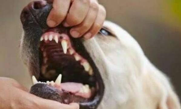 كلاب تنهش وجه طفل في المفرق