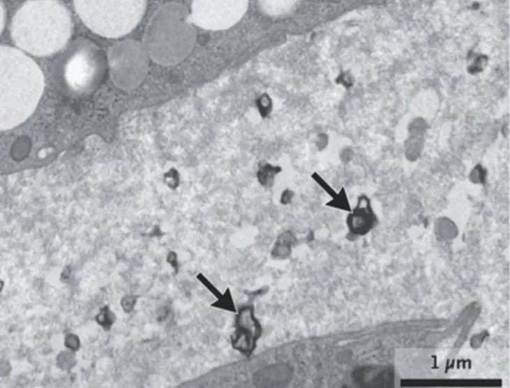 الجسيمات البلاستيكية الدقيقة في علب الطعام تهدد الدماغ بخطر ألزهايمر