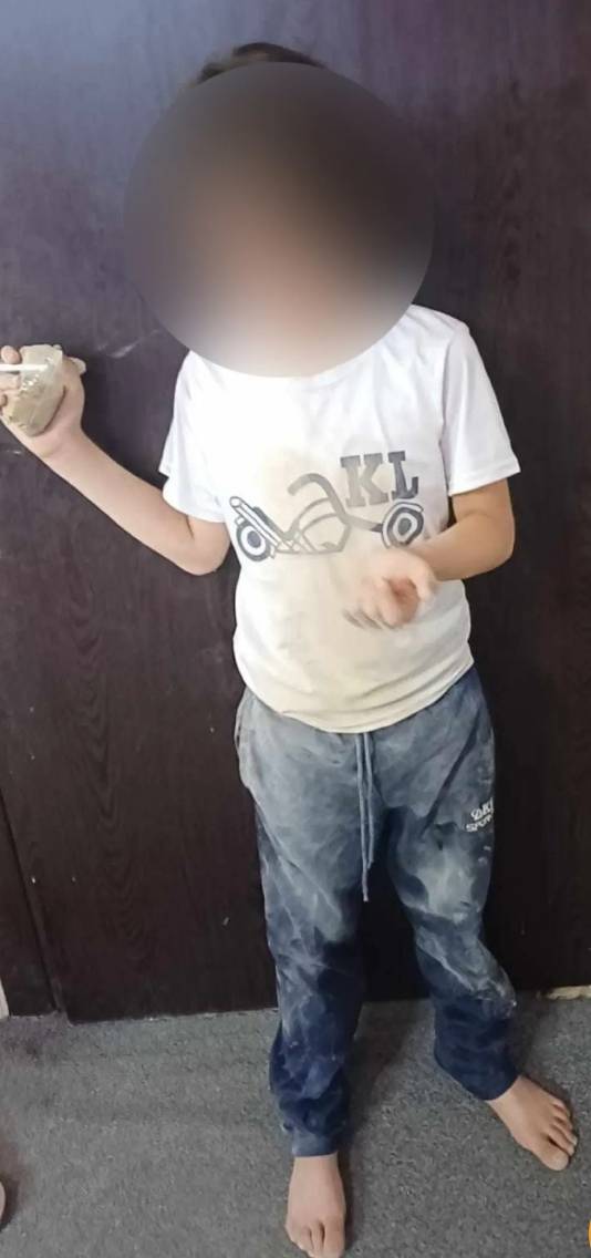 الكلاب الضالّة تهاجم طفلا في الزرقاء