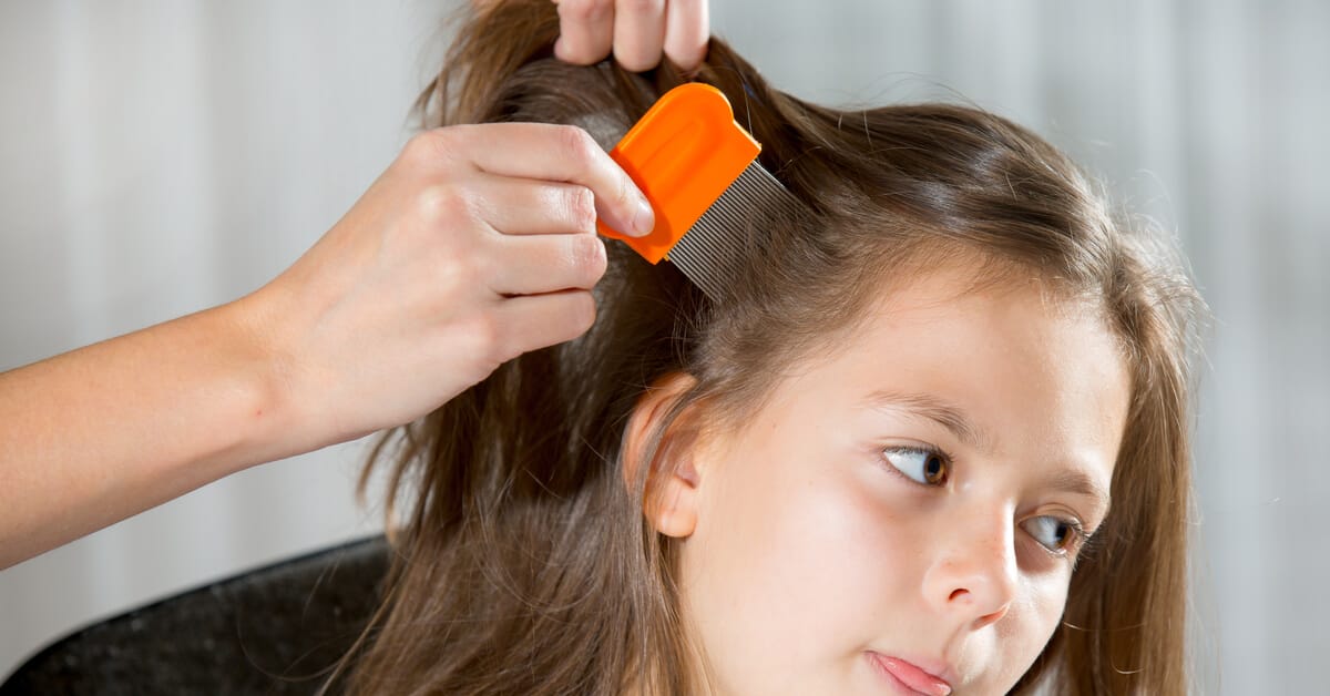 كيفية الوقاية من قمل الرأس عند الأطفال.. نصائح مهمة للآباء والأمهات