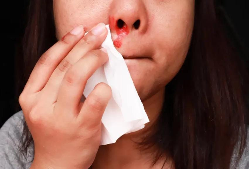 نزيف الأنف عند الأطفال.. الأسباب، الإسعافات، ومتى يجب القلق؟