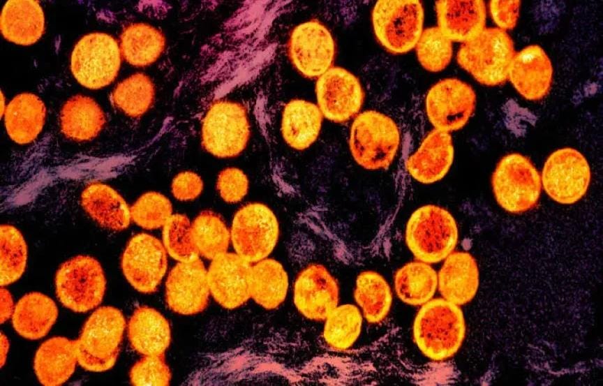 انتشار سلالة خطيرة من جدرى القرود في كاليفورنيا يثير قلق السلطات الأمريكية