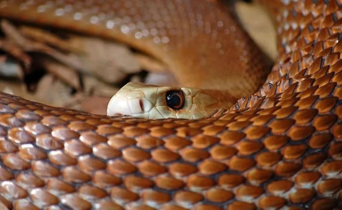 لدغة أفعى خطرة تتسبب باشتباه غرغرينة لطفلة في الكرك