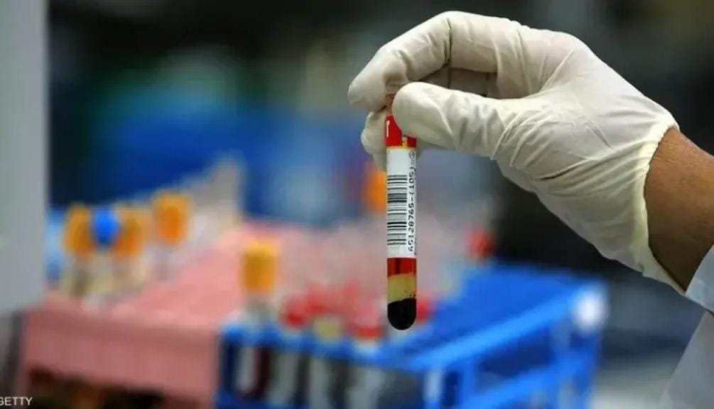 4 تحاليل طبية ضرورية بعد الأربعين… اكتشفها قبل أن تتفاجأ بالنتائج