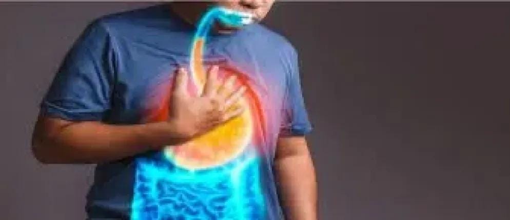 ارتجاع المريء.. الأعراض والأسباب وكيفية التعامل معه