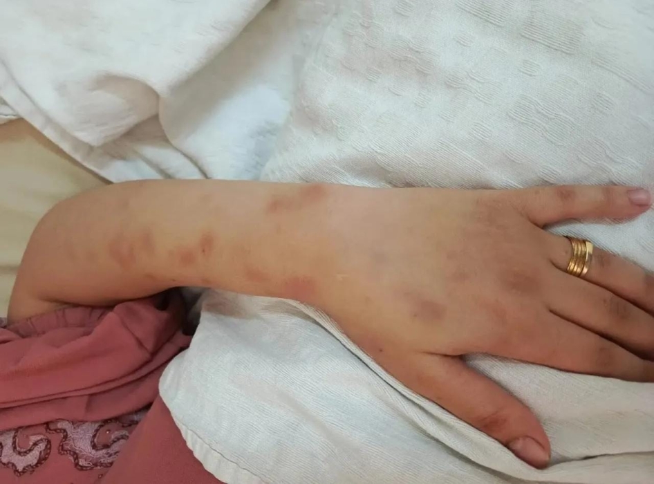 الزرقاء...وفاة أردنية إثر تعرضها للتعذيب والضرب على يد زوجها