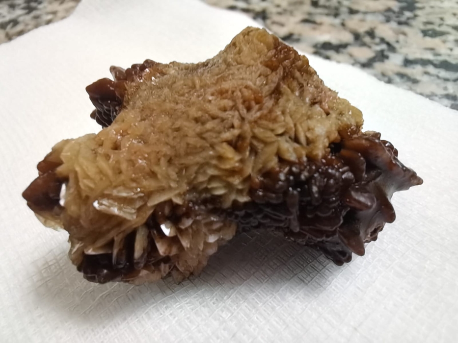 مادبا: عملية نوعية لاستخراج حصوة كبيرة من الكلى باستخدام المنظار