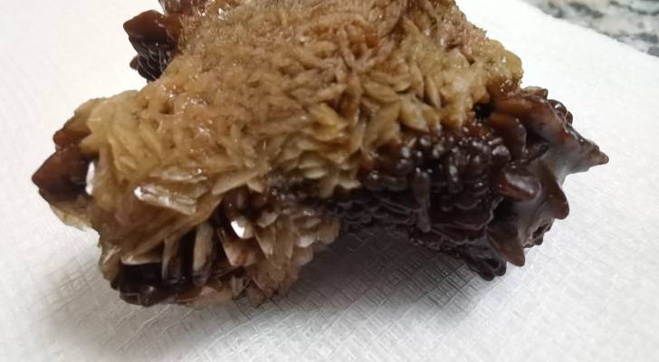 لأول مرة في الأردن.. نجاح عملية نوعية بالمنظار لاستخراج حصوة 4 سم بمستشفى النديم