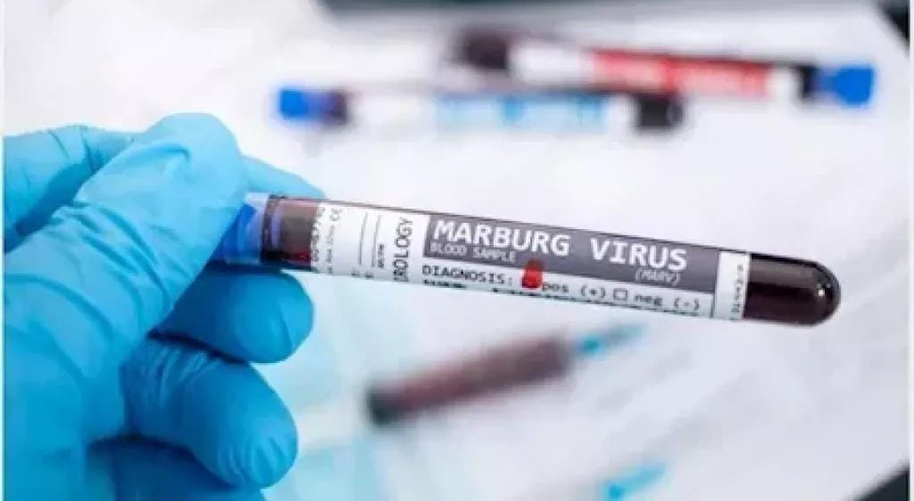 فيروس ماربورج.. اكتشف مكان انتشاره وأعراضه وكل ما تريد معرفته عنه