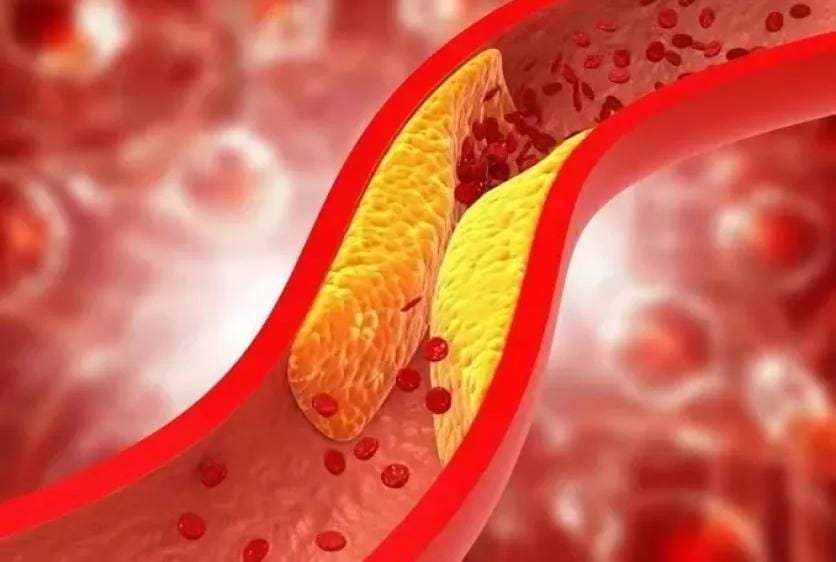 ست عادات صباحية ترفع الكوليسترول الضار… تعرف عليها