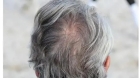 الشيب ظاهرة طبيعية.. وهذه العوامل تسرّع ظهوره